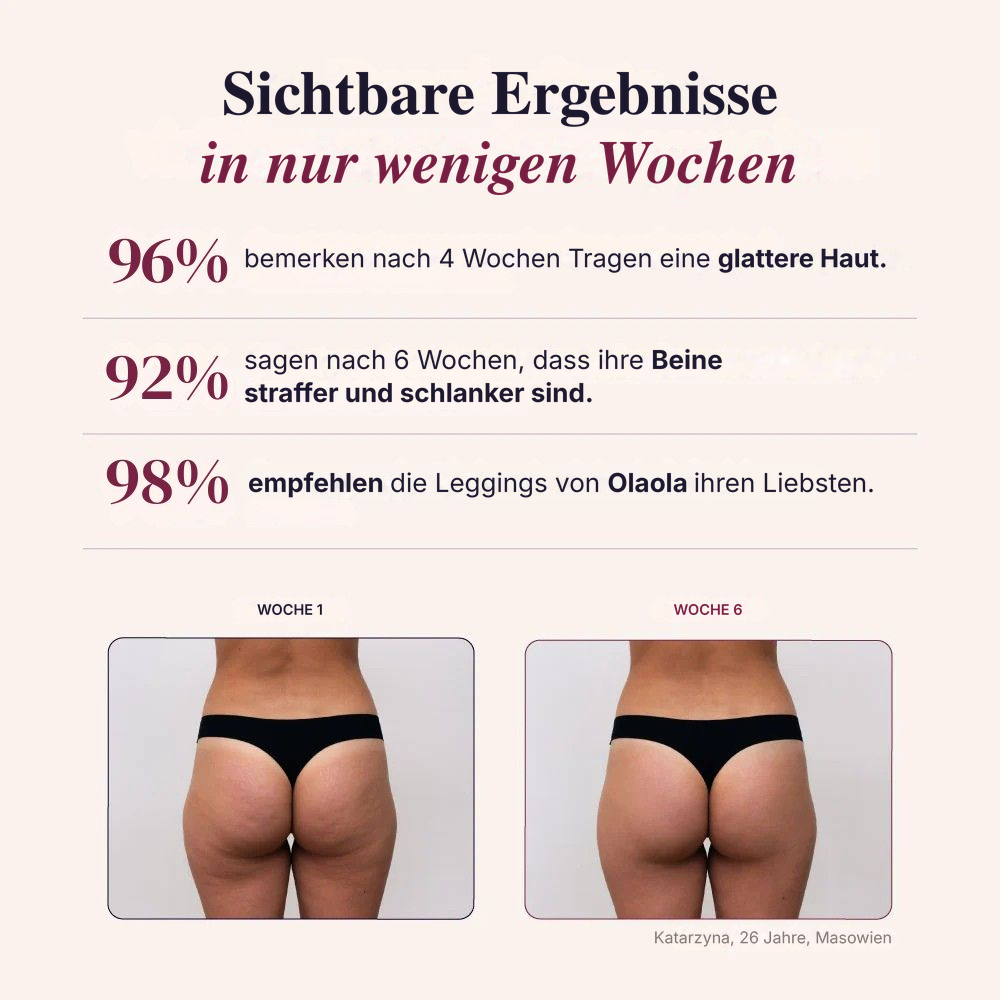 3D-Shaping-Leggings – Push-up & Anti-Cellulite
